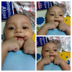 Kriby udah bisa senyum dua jari