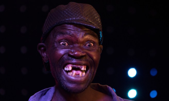 Inilah dia Mr. Ugly 2015 yang menuai kontroversi. (Foto: Izin nyomot dari Google)